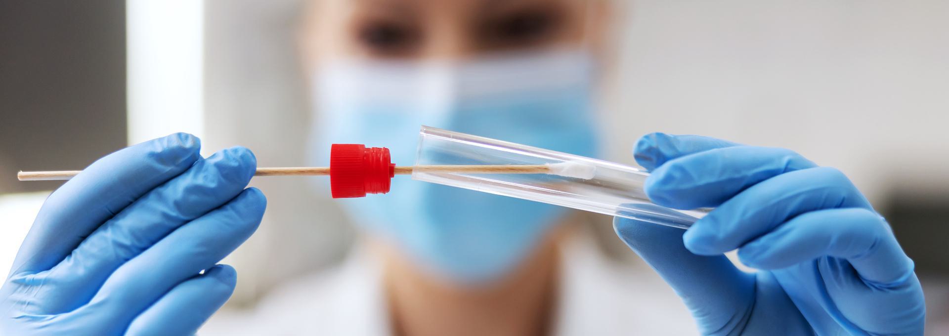 Avuncular (Aunt/Uncle) DNA Tests Person in mask and gloves handling a swab test tube.