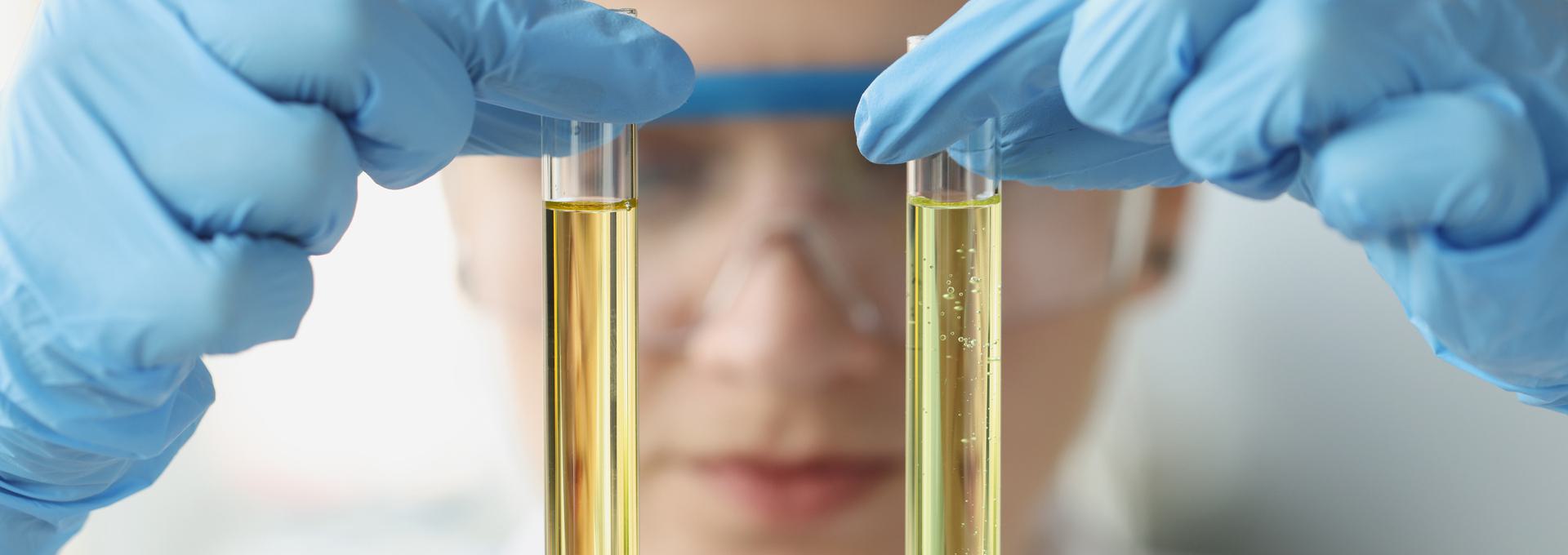 23 Panel Urine Drug Test Scientist examining two test tubes with yellow liquid, wearing blue gloves and safety goggles.