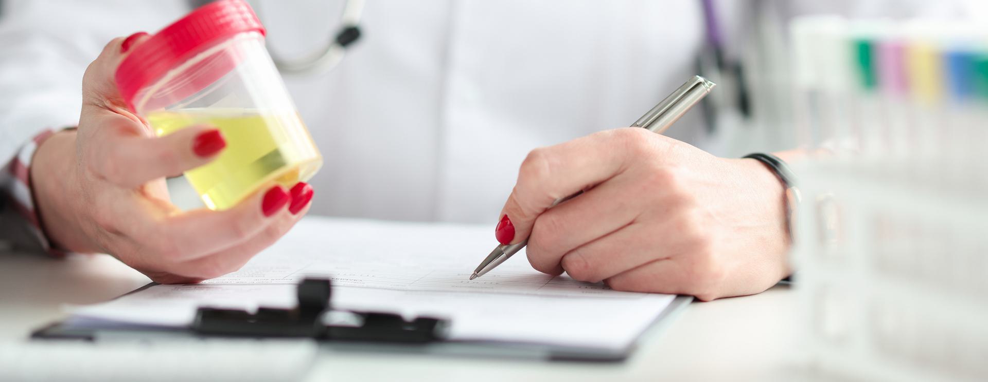 Person holding a urine sample container while writing on a clipboard, wearing a stethoscope.