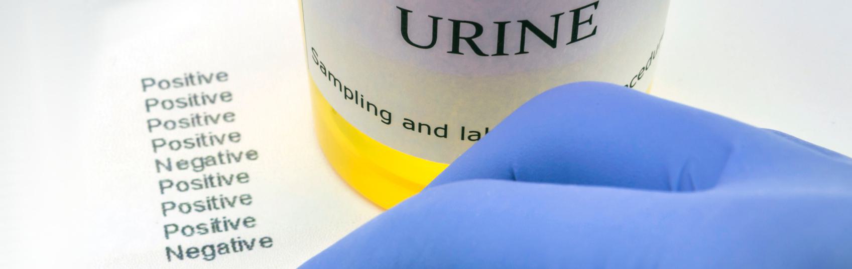 DOT Prior Positives and Refusals Urine sample container with test results labeled positive and negative, next to a gloved hand.