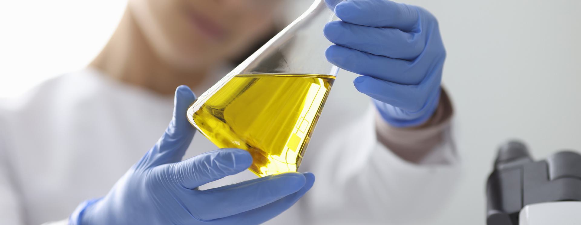 Scientist wearing blue gloves examining a yellow liquid in a conical flask.