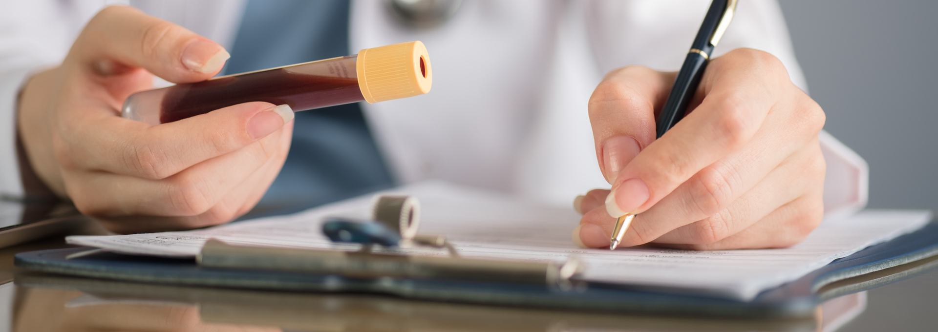 CMP Blood Test - Comprehensive Metabolic Panel Person holding a blood sample tube while writing on a clipboard.