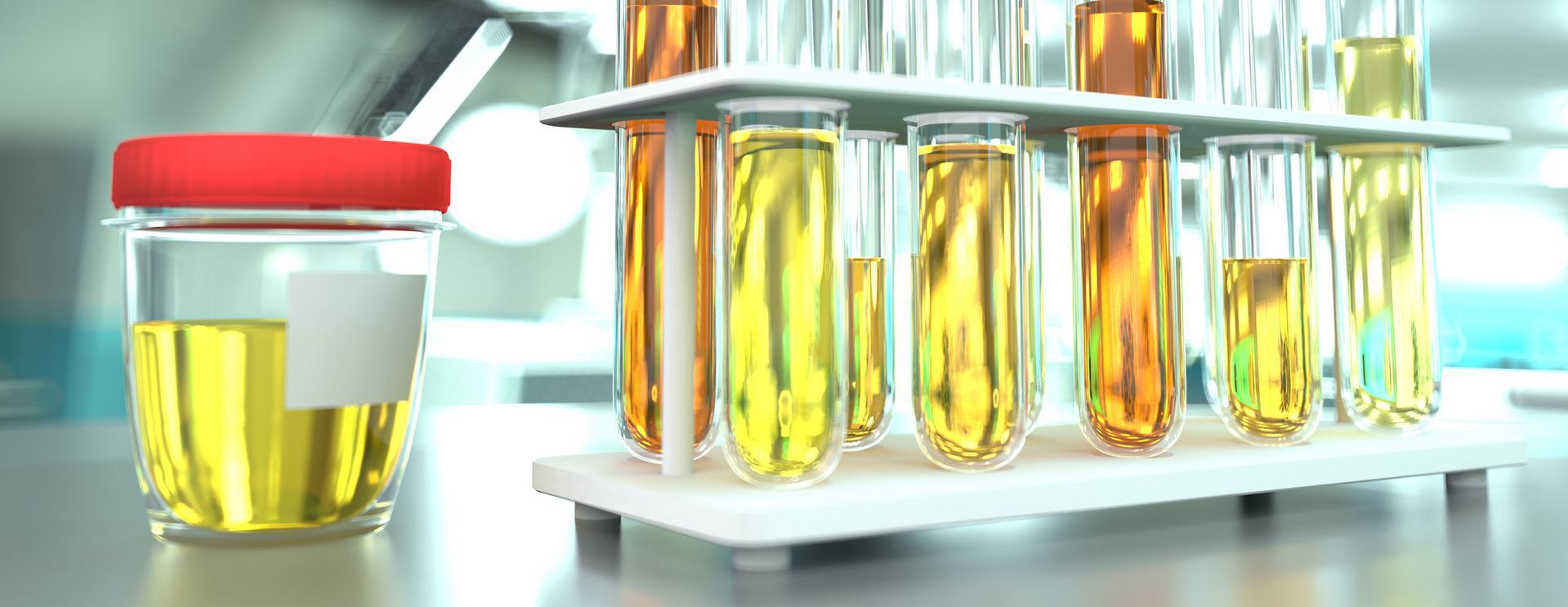 16 Panel Opiate Drug Test Laboratory setting with test tubes filled with yellow and orange liquids, alongside a sample jar with a red lid.