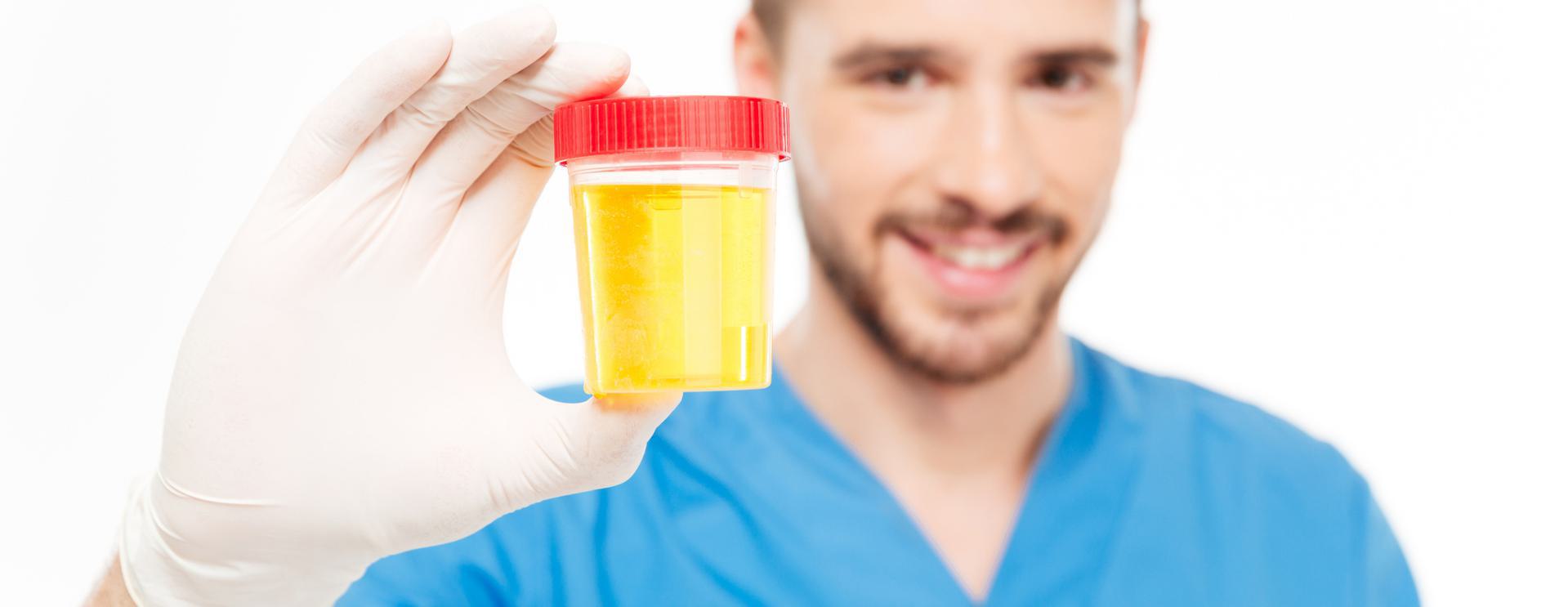 12 Panel Drug Test Smiling person in blue scrubs holding a urine sample container with a red lid, wearing white gloves.