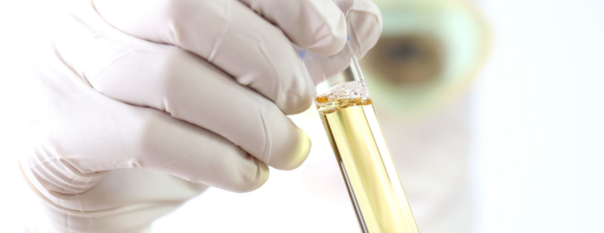 Scientist wearing gloves holding a test tube with urine.