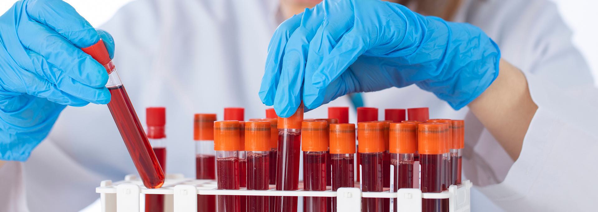 Scientist handling blood samples in test tubes with blue gloves.