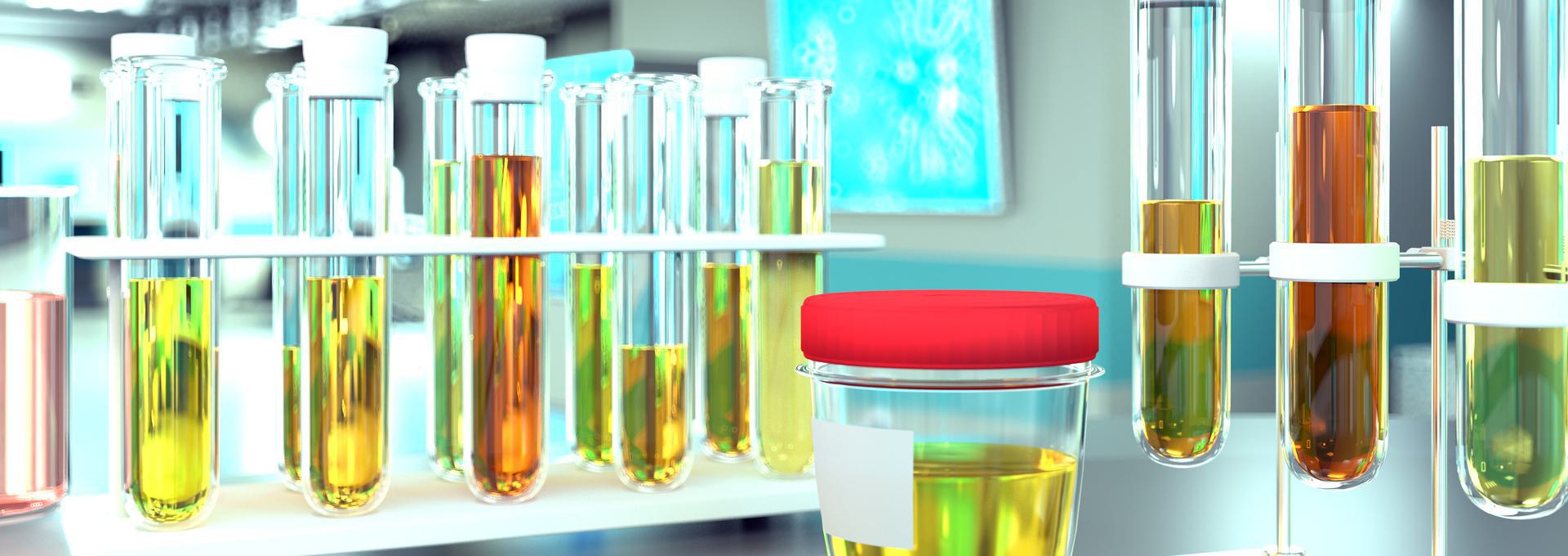 Laboratory test tubes with various colored liquids and a sample container with a red lid on a lab bench.