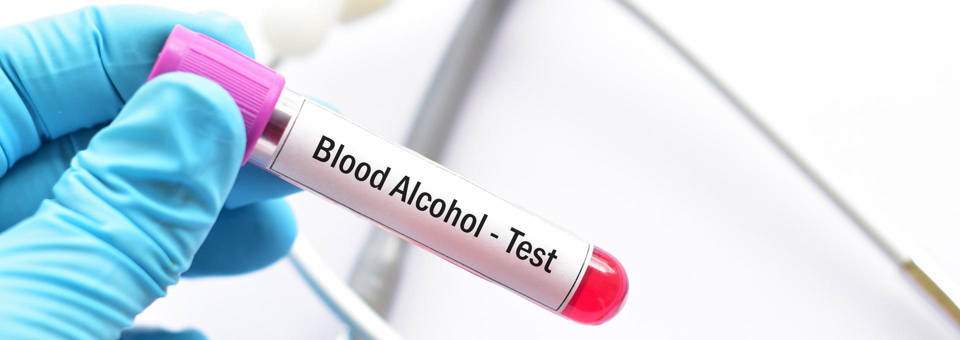 Gloved hand holding a blood sample tube labeled 'Blood Alcohol - Test'.