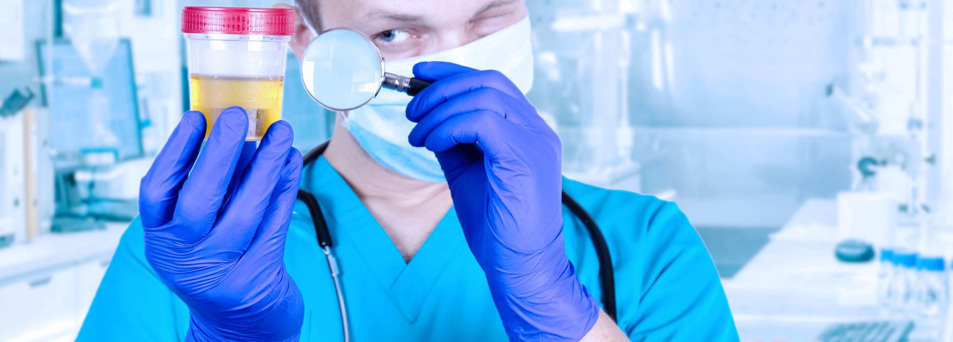 Medical professional in blue scrubs and gloves examining a urine sample with a magnifying glass in a laboratory setting.