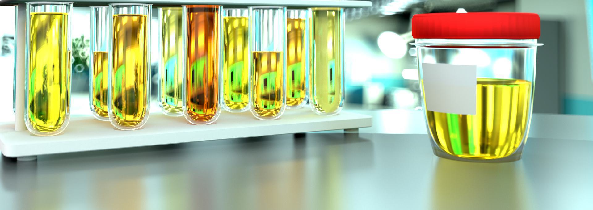 HHS Drug Test Test tubes with urine in a rack and a sample jar with red lid on a laboratory table.